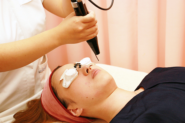 ステップ3 照射:レーザーを照射